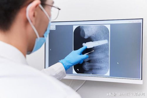 种植牙前如何选择方案治疗