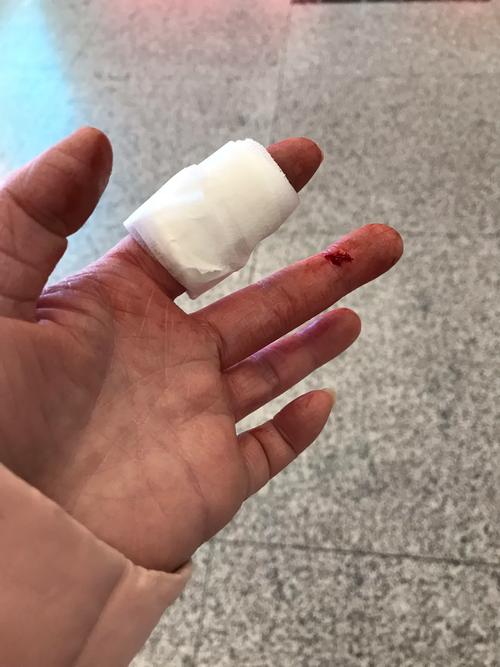 孕妇舔水果刀怎么办视频